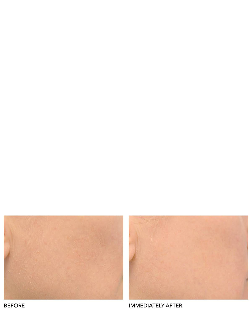 Clinical Grade Resurfacing Liquid Peel F17372