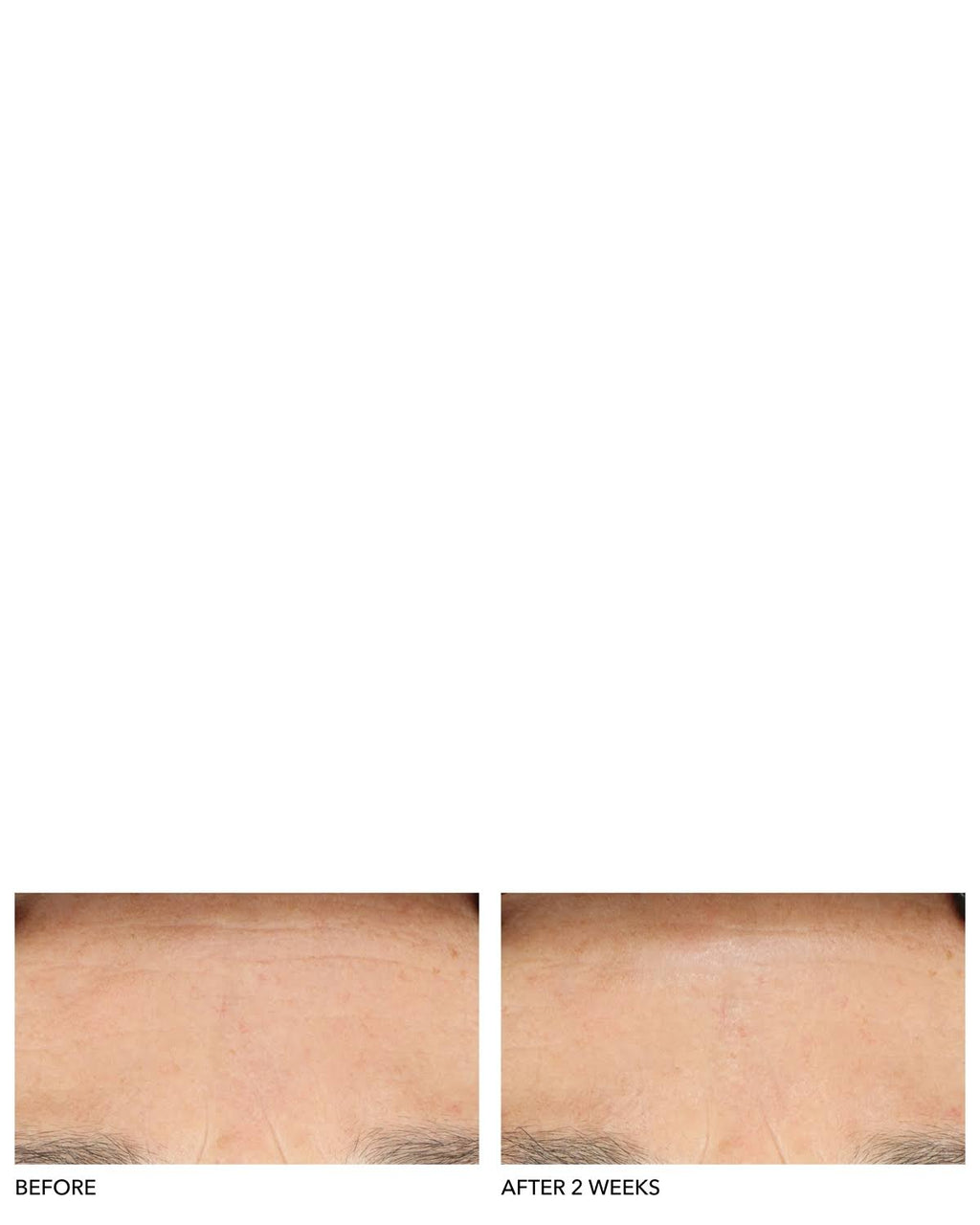 Clinical Grade Resurfacing Liquid Peel F17372