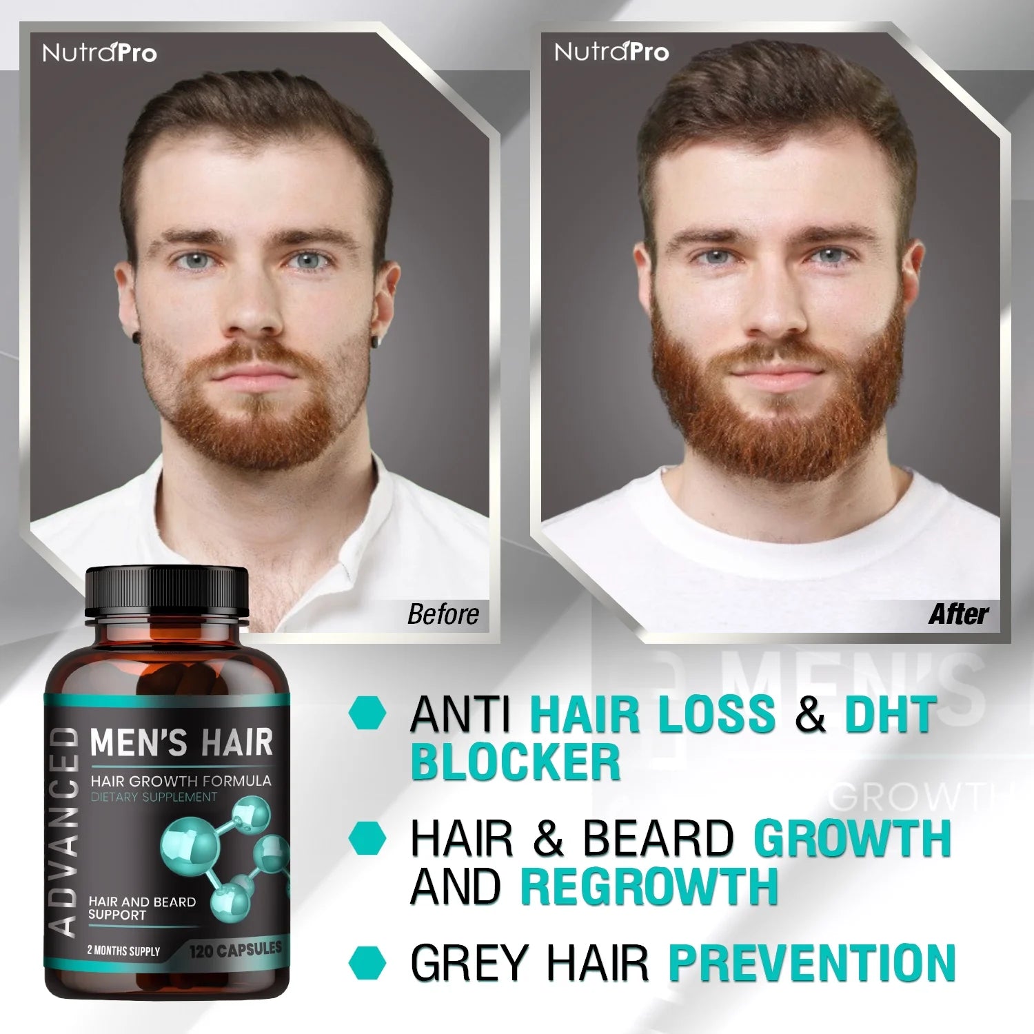 Hair Growth Vitamins For Men Pills E87889
